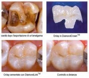 Conservativa ed Estetica